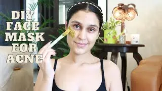 DIY FACE MASK FOR ACNE/ACNE SCARS | DIY SUNDAYS | Chetali Chadha