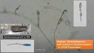 Cylindrocarpon growth on SDA and its hyphae, chlamydospores and conidia