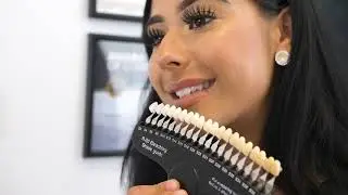Naturawhite No.1 Teeth Whitening