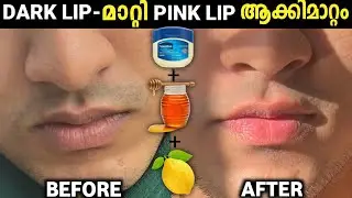 Increase Lip Colour | Reduce Pigmentation (Lip care for Men)