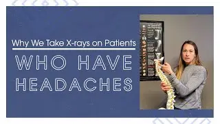 Why We Take X Rays On Patients Who Have Headaches | Chiropractor for Headaches in Inver Grove MN