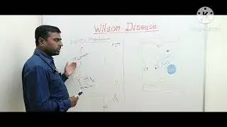 Wilson Disease..Part-1...Pathogenesis, biochemistry copper metabolism..For MBBS, MD and DNB students