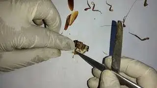 Digestive System of Cockroach