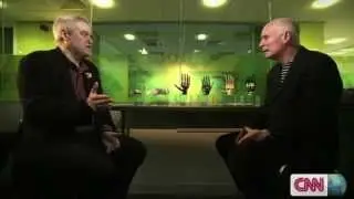 Advanced bionic hand is changing lives