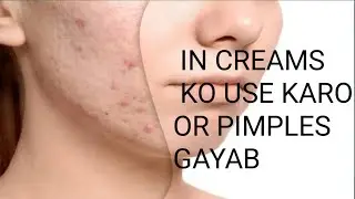 Good Result Cream/Gel For Pimples and Acne #youtube #review #skincare 