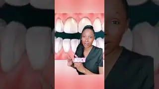 What happens when you drink too much soda #soda #teeth #dentaltips #explained