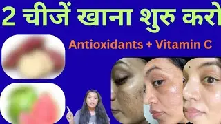इन दो चीजों से होगी✨Antioxidants + 🫒Vitamin-C की कमी पूरी/Diet for Pigmentation & Dark Spots/झाइ