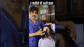 20-Year-Old Alopecia Reversed in 2 Months | Ayurvedic Hair Treatment by Dr. Mukesh Aggarwal