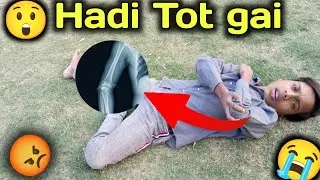 Park mein khelte Hue Hath Tut Gaya alien ka😲 🦾😭⛹️‍♂️