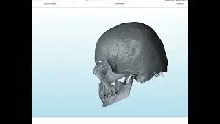 Sch&auml;del Scan mit dem FARO Leap ST 3D Handscanner