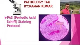 PAS stain in Histology. PAS staining histology in Hindi. pas stain in histopathology procedure.