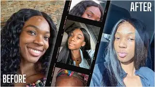 How I BURNED my forehead | Products to clear hyperpigmentation FAST *Storytime*
