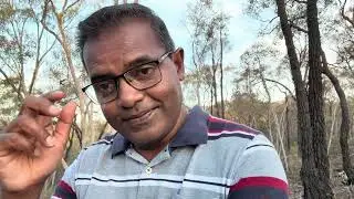 ඔස්ට්‍රේලියාවේ වෛද්‍ය ශිෂ්‍යයෙක් වෙන්න යන  ( මෙඩිසින් යන ) අය වැඩි පිරිසකගේ පසුබිම කුමක්ද #medicine