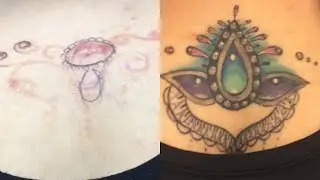 Littekens verbloemen met tattoo - @ Tattoo Dex
