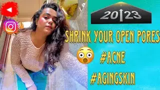 How to treat open pores / Truth,Facts and Myths about it/ enlarged pores/ Cause and Treatment/PART 1