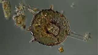 CENTROPYXIS TECAMEBA