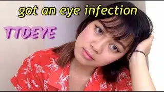 Honest TTDEYE review