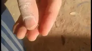 adult stage of OEstrus ovis after culture, المشخص في البيطرة: الطور البالغ لحشرة الأوستروس أوفيس 2
