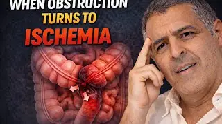 Small bowel obstruction explained