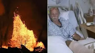 'Lava bomb' shatters leg of SoCal native living in Hawaii | ABC7