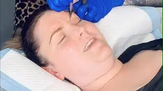 Microshaded Brows - Ombre Brows cosmetic tattoo procedure.