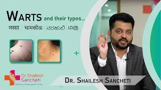 Warts | मस्सा | चामखीळ | ನರಹುಲಿ | மரு  | Cure with Homeopathy | DR SHAILESH SANCHETI |