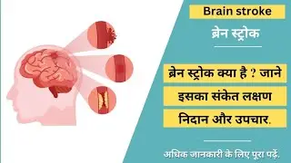 Brain Strock | ब्रेन स्ट्रोक क्या है ? जाने । Brain Death | Strock |Sarathi Classes |Balwant Nagar