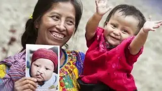Cydcor Operation Smile&mdash;Day of Smiles 2016 | Cydcor