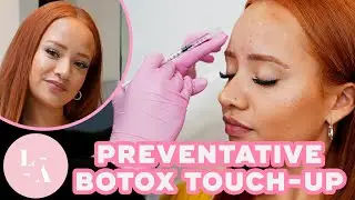 Kim | Botox Touch-Up Experience