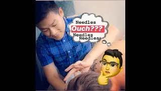 About Acupuncture NEEDLES & NEEDLING / Allen Liu Acupuncture