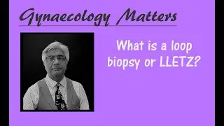 What is a loop biopsy of cervix or LLETZ?