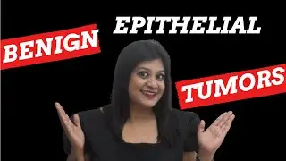 BENIGN EPITHELIAL TUMORS| DENTISTRYBYPRATS