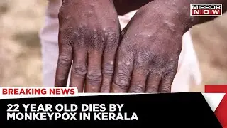 1st Death Of Monkeypox In India Reported In Kerala | Patient Returned From UAE