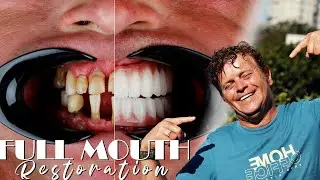 We were happy to welcome our patient Robert Colquhoun from the UK to the Dental Wise Turkey family.