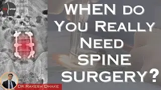 Do You Really Need Spine Surgery? Find Out Now!