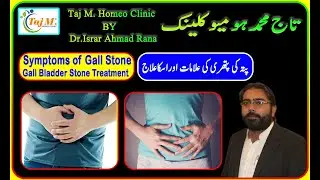 Gall Bladder Stone Treatment in Hindi/Urdu | Gall Bladder Stone Removal Homeopathy in Hindi | #viral