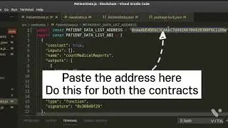 Simple Blockchain application to store Patient data.