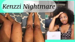 KENZZI laser hair removal REVIEW and NIGHTMARE UPDATE!  #Storytime WATCH this BEFORE you BUY IT!
