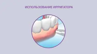Видео инструкция Jetpik JP50/200 USA |  Как пользоваться ирригатором для полости рта