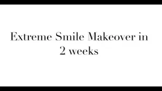 Extreme Smile Makeover in 2 Weeks - Dental Tourism India - Nanda Dental Clinic