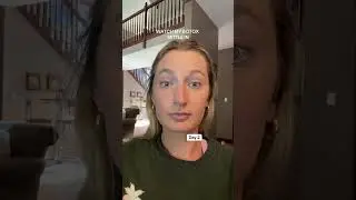 Watch My Botox Settle In #botoxresults #botoxinjection #babybotox #preventativebotox
