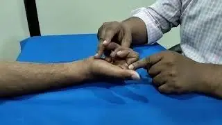 glass cut injury & its role of physiotherapy#ulnarnerve #radialnerve #mediannerve #clawhand#joints