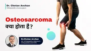 Osteosarcoma क्या होता है?|  What is Osteosarcoma (Hindi) | Haddi ka cancer | Dr Chetan Anchan