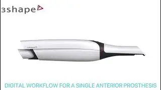 digital scan crown of a tooth with 3shape trios 3 scanner