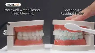 Mornwell Water Flosser Teeth Picks 4 Jets 3 Modes Portable Cordless D