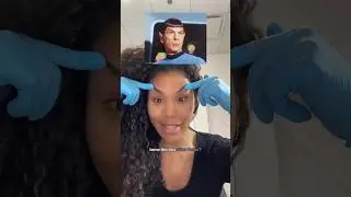 Botox brow lift- don&rsquo;t make this mistake! #botox #browlifting #botched #cosmeticinjectables