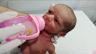 Low Birth Weight Baby Feeding and Oil Massage | NICU Care #NewbornCare #BabyMassage