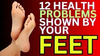 12 Health Problems Shown by Your Feet You Should Never Ignore!