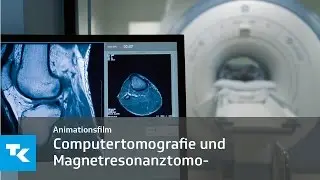 Schicht für Schicht: Animationsfilm zur Computertomografie und Magnetresonanztomografie
