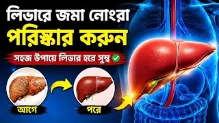 ফ্যাটি লিভার থেকে মুক্তির উপায় | Liver Detox Naturally #liver #livercare